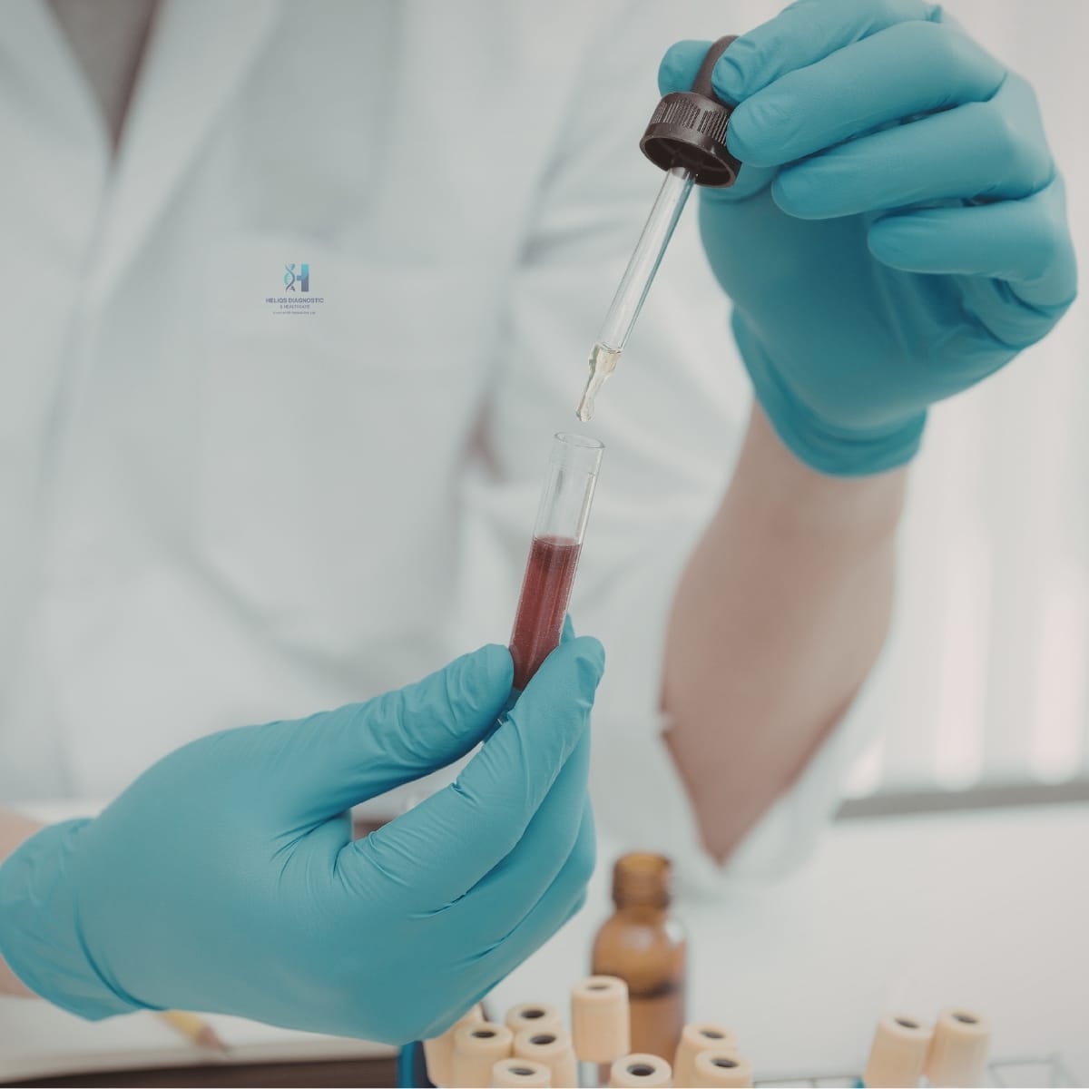 Lab technician using a pipette dropper to transfer a blood sample into a vial for clinical testing.