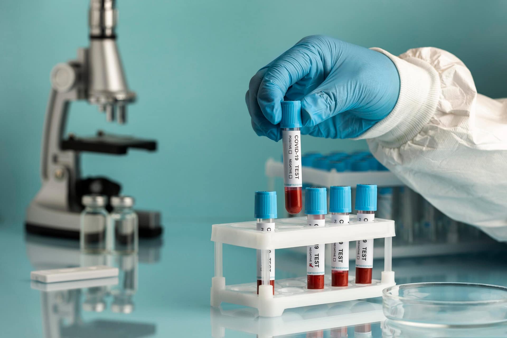 A lab technician wearing blue nitrile gloves handling a test tube containing a blood sample in a laboratory setting, with a microscope and additional vials in the background.